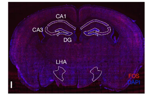 Nature:科学家发现记忆如何控制新陈代谢 Nature:科学家发现记忆如何控制新陈代谢