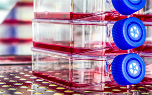 生物制药与疫苗生产中的细胞培养全流程解决方案 生物制药与疫苗生产中的细胞培养全流程解决方案