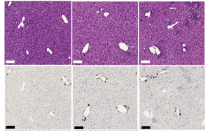 CD4+ T细胞通过激活库普弗细胞分泌IL-27逆转HBV诱导的CD8+ T细胞功能障碍的机制研究