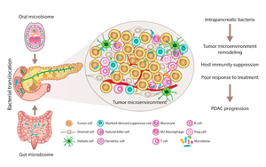 JAMA Oncology:口腔微生物群与胰腺癌风险相关 JAMA Oncology:口腔微生物群与胰腺癌风险相关