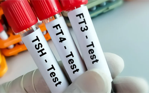 总及游离甲状腺素(TT4及FT4)-磁微粒化学发光法(AE/AP)解决方案(双抗体夹心法) 总及游离甲状腺素(TT4及FT4)-磁微粒化学发光法(AE/AP)解决方案(双抗体夹心法)