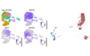 Nature破解科学谜题：终于找到了最常见的染色体异常引发心脏缺陷的关键基因