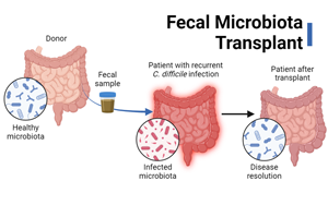 Nature Microbiology：新方法可追踪肠菌移植后的微生物菌株