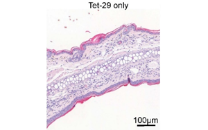 Science Signaling：深入了解糖类如何调节炎症性疾病过程