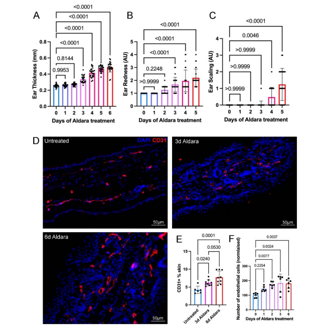 描述银屑病样皮肤炎症过程中炎症临床体征与血管系统的变化特征 描述银屑病样皮肤炎症过程中炎症临床体征与血管系统的变化特征