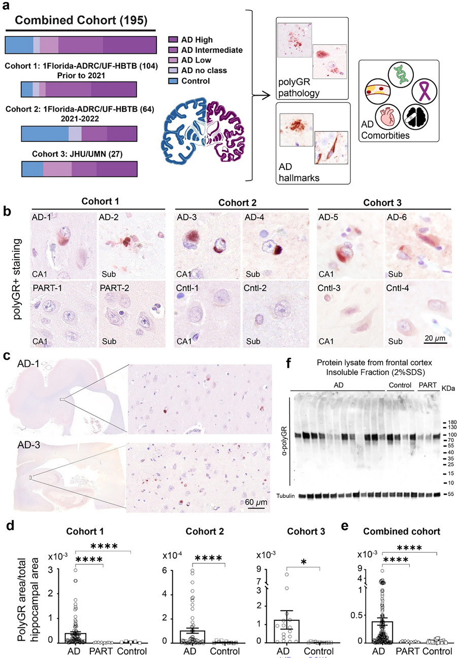 在多组阿尔茨海默病尸检脑样本中,海马体频繁检测到PolyGR+ 蛋白聚集物 在多组阿尔茨海默病尸检脑样本中,海马体频繁检测到PolyGR+ 蛋白聚集物