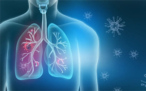 呼吸道感染病原体检测高品质原料推荐