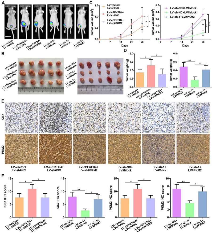 cPFKFB4通过PKM2促进胰腺癌恶性进展 cPFKFB4通过PKM2促进胰腺癌恶性进展
