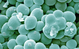 工程化产丁酸酵母通过协同作用改善阿尔茨海默病相关表型