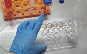 精准营养，塑造未来：类器官培养基的新纪元