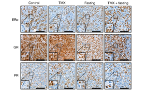 禁食通过激活糖皮质激素来提高乳腺癌治疗的疗效