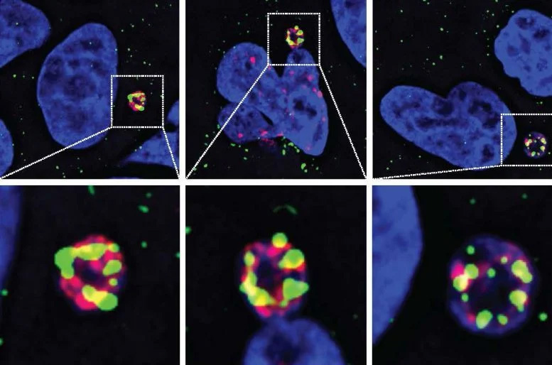 N4BP2酶(绿色)渗入微核并在其中引发DNA损伤(红色) N4BP2酶(绿色)渗入微核并在其中引发DNA损伤(红色)