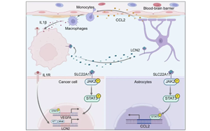脂质运载蛋白-2通过肿瘤-微环境互作驱动肺癌脑转移进展