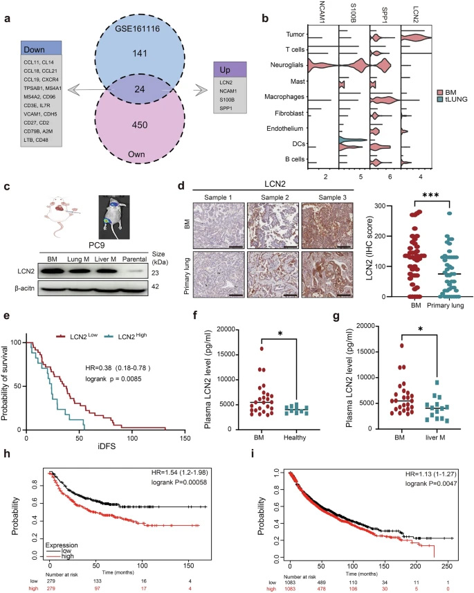 LCN2在脑转移组织中过表达,且与肺癌患者的不良预后相关 LCN2在脑转移组织中过表达,且与肺癌患者的不良预后相关