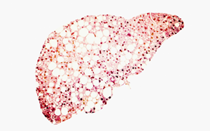 Cell：高脂饮食迫使肝细胞自保，却最终诱发肝癌