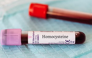 同型半胱氨酸（HCY）-磁微粒化学发光法（AE/AP） +荧光免疫层析解决方案