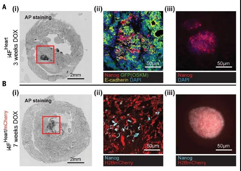 Science重磅：局部重编程让心肌细胞“返老还童” 让心脏实现再生！