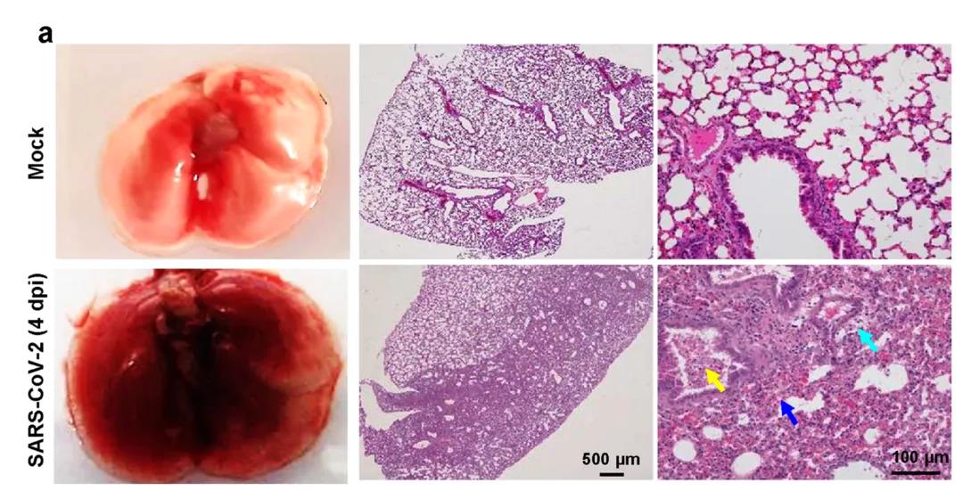 ​建模成功！Nature子刊：成功建立新冠肺炎重症模型，揭示新冠病毒感染的分子机制