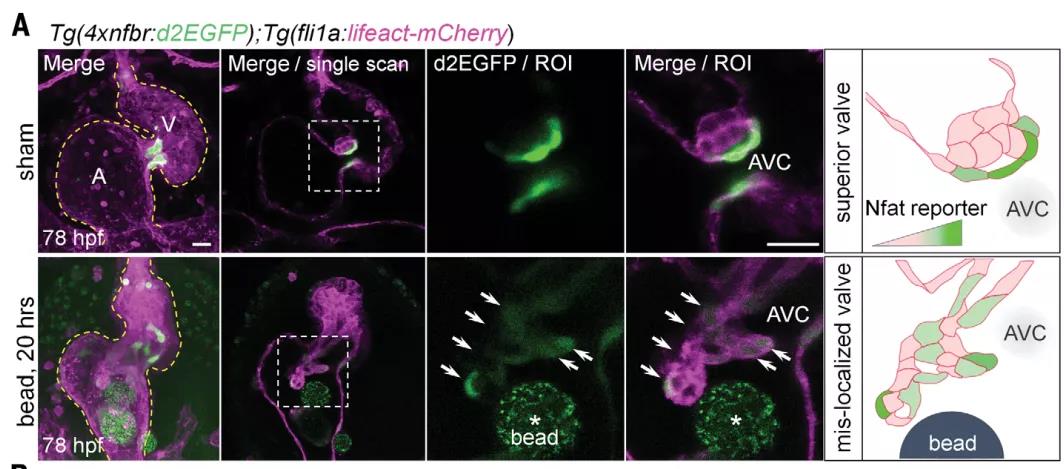 心脏发育机制的大发现！Science：机械应力对心脏瓣膜形成过程的调控机制