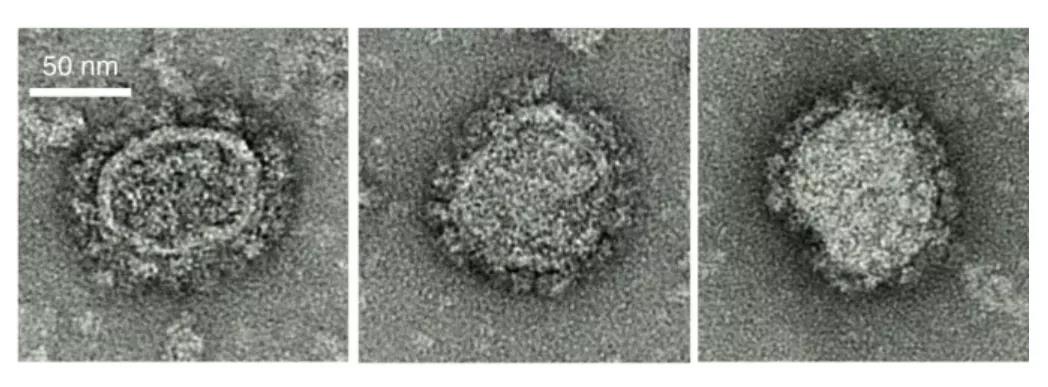 Nature子刊：防“艾”疫苗有望 恒河猴感染风险降低79%