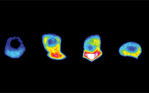 Developmental Cell：为入侵细胞的“前线”提供燃料