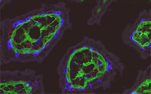是什么驱使T细胞保护肠道，这是一个有趣的新发现
