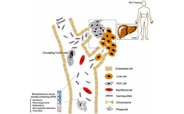 肝细胞癌中的循环肿瘤DNA