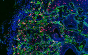 到底是什么驱动了癌细胞？最新Nature给出了答案：癌症干细胞的对话