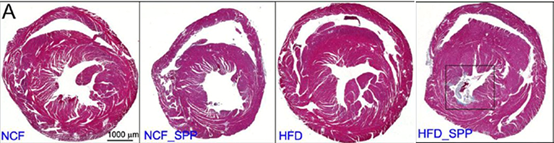 接种Spp病毒的高脂饮食小鼠心肌出现明显的纤维化