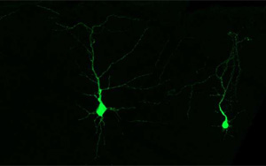 《Cell》发育中的神经细胞利用必需氨基酸的机制