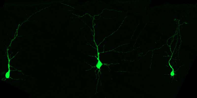 在大脑发育过程中，缺少某些氨基酸的神经元会在出生后对小鼠产生严重影响。
