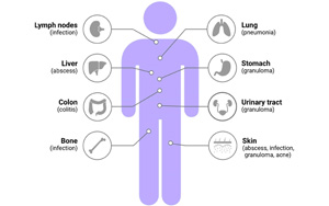 mNGS在诊断血流感染方面优于常规微生物检测