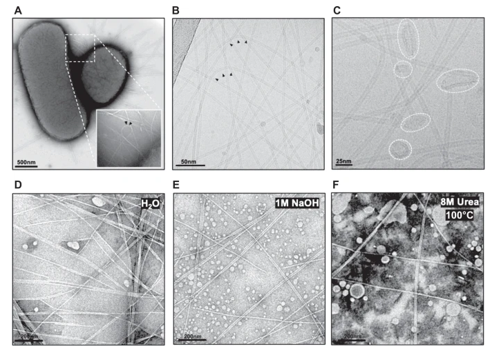 完整细菌和纯化F-pili的电子显微镜显微照片