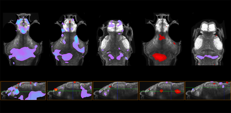 在五种具有自闭症相关基因变异的斑马鱼模型中，前脑的大小增加（紫色）或减少（红色）。