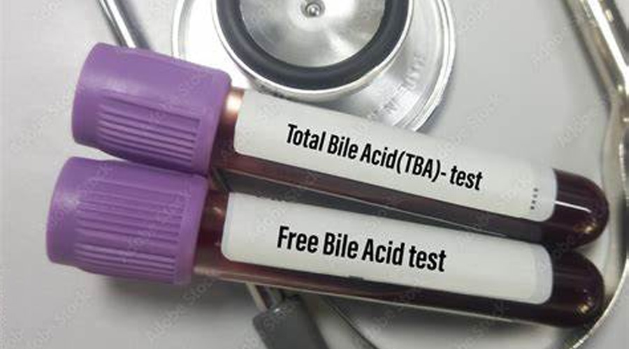 总胆汁酸（TBA）检测