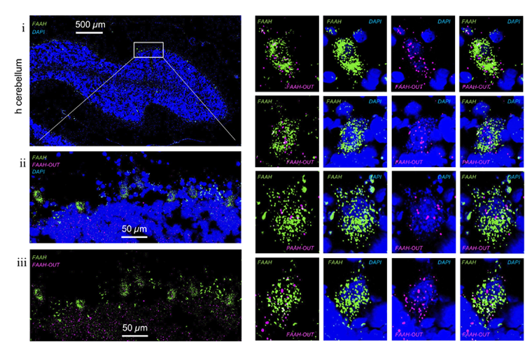 FAAH和FAAH-OUT RNA在人脑组织细胞中的表达水平和定位