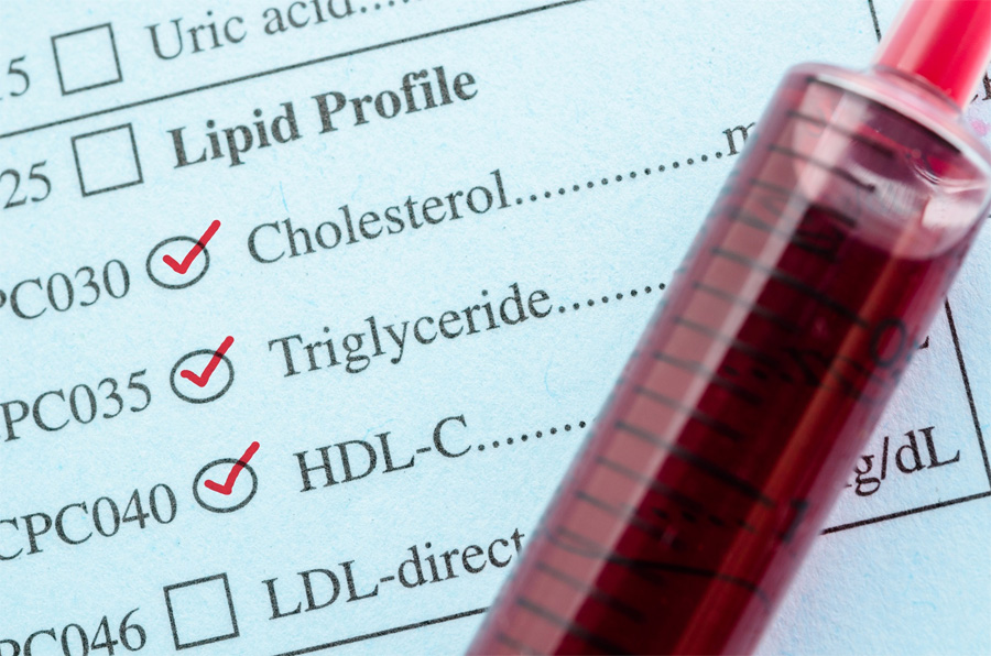 高/低密度脂蛋白胆固醇（HDL /LDL-C）检测