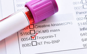心肌肌钙蛋白T（cTnT）-磁微粒化学发光法（吖啶酯） /荧光免疫层析解决方案