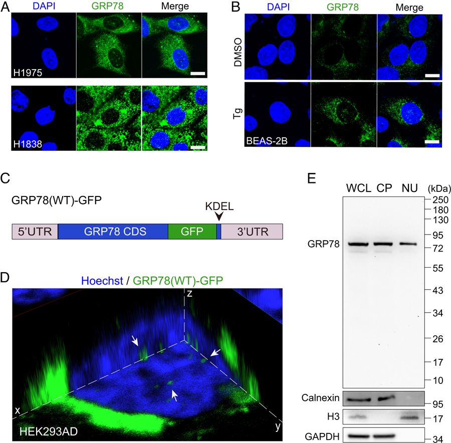 GRP78定位于人癌症细胞和内质网应激细胞的细胞核。