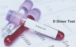 D-二聚体（D-Dimer）-磁微粒化学发光法（吖啶酯） /荧光免疫层析解决方案