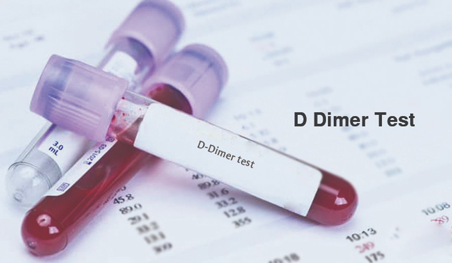 D-Dimer检测