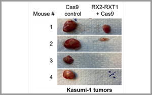 Leukemia：基于CRISPR的基因疗法为白血病治疗带来希望