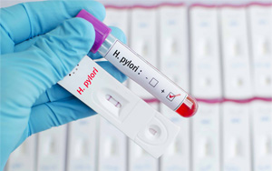 幽门螺旋杆菌抗原（HP）-免疫层析（胶体金及彩色乳胶）解决方案