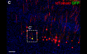 《Neuron》科学家发现脑力更新的生物标志物