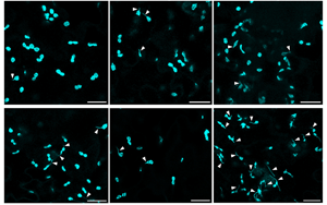 Science Advances：叶绿体的作用不仅仅是光合作用！免疫防御中隐藏的玩家