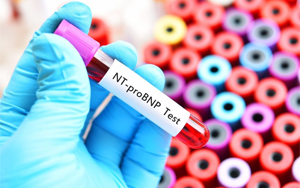 氨基末端脑利钠肽前体（NT-proBNP）-荧光免疫层析解决方案