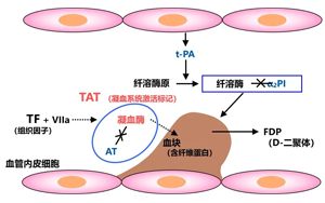  纤溶酶-α2纤溶酶抑制物复合物（PIC）-磁微粒化学发光法 （吖啶酯）解决方案