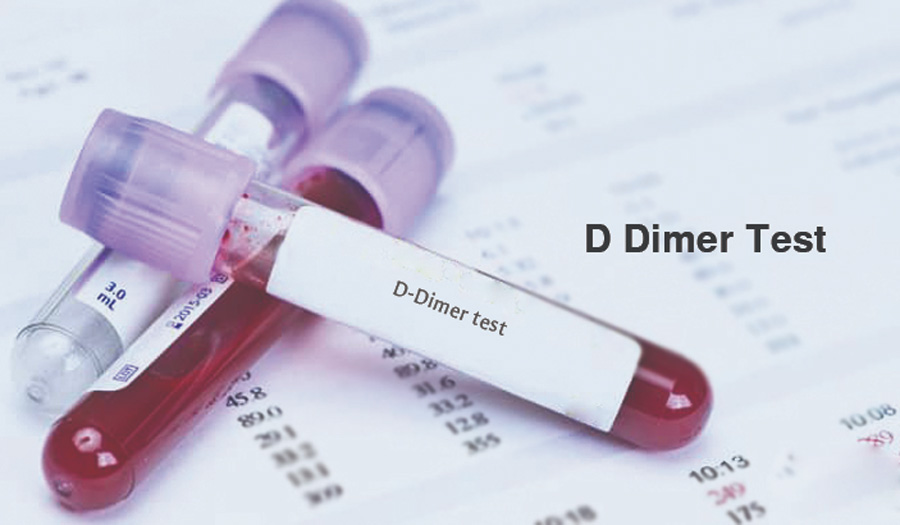 D-二聚体(D-Dimer)-磁微粒化学法学发光(AP/AE) /荧光免疫层析解决方案