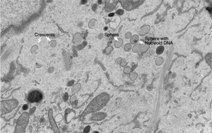 Nature Microbiology：一种以前未知的免疫反应途径