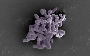 Science Immunology：一种肠道细菌可以增强免疫反应，增强癌症免疫治疗